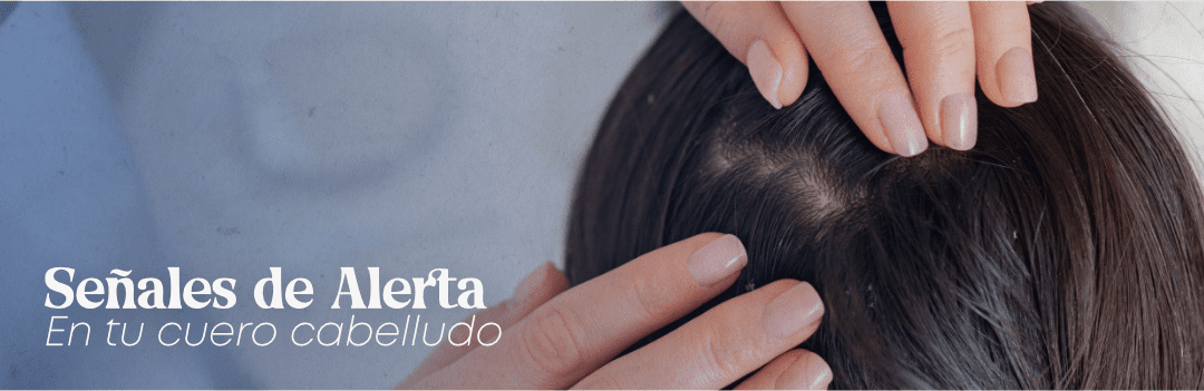 blog señales de alerta