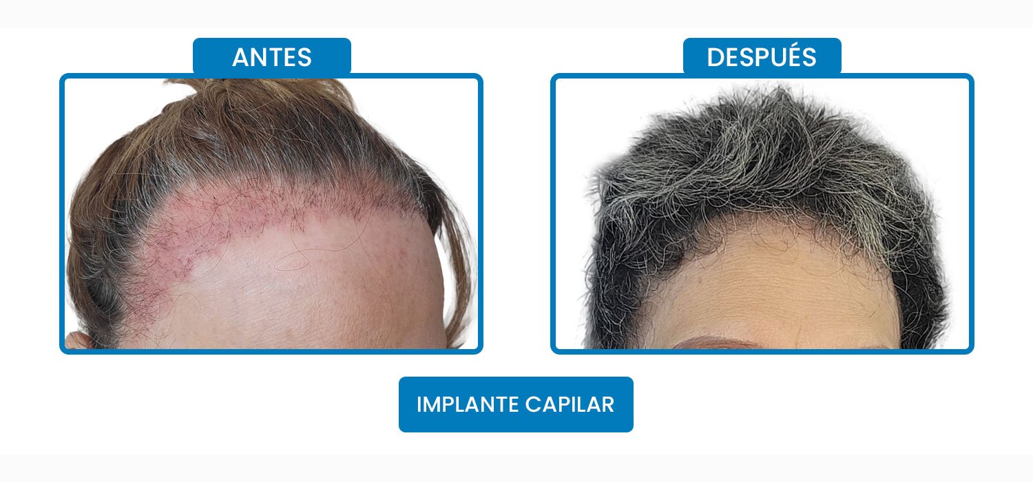 amparo.jpg