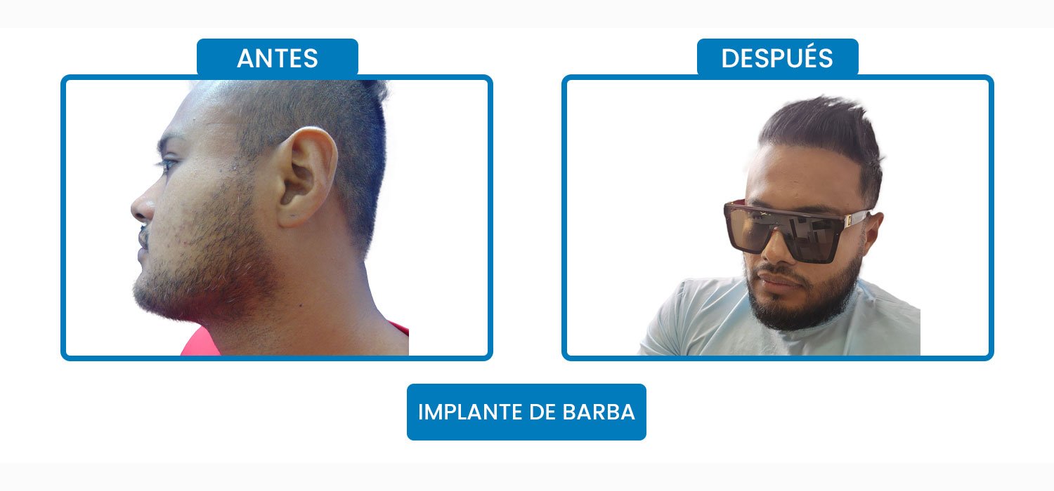 jhon.jpg