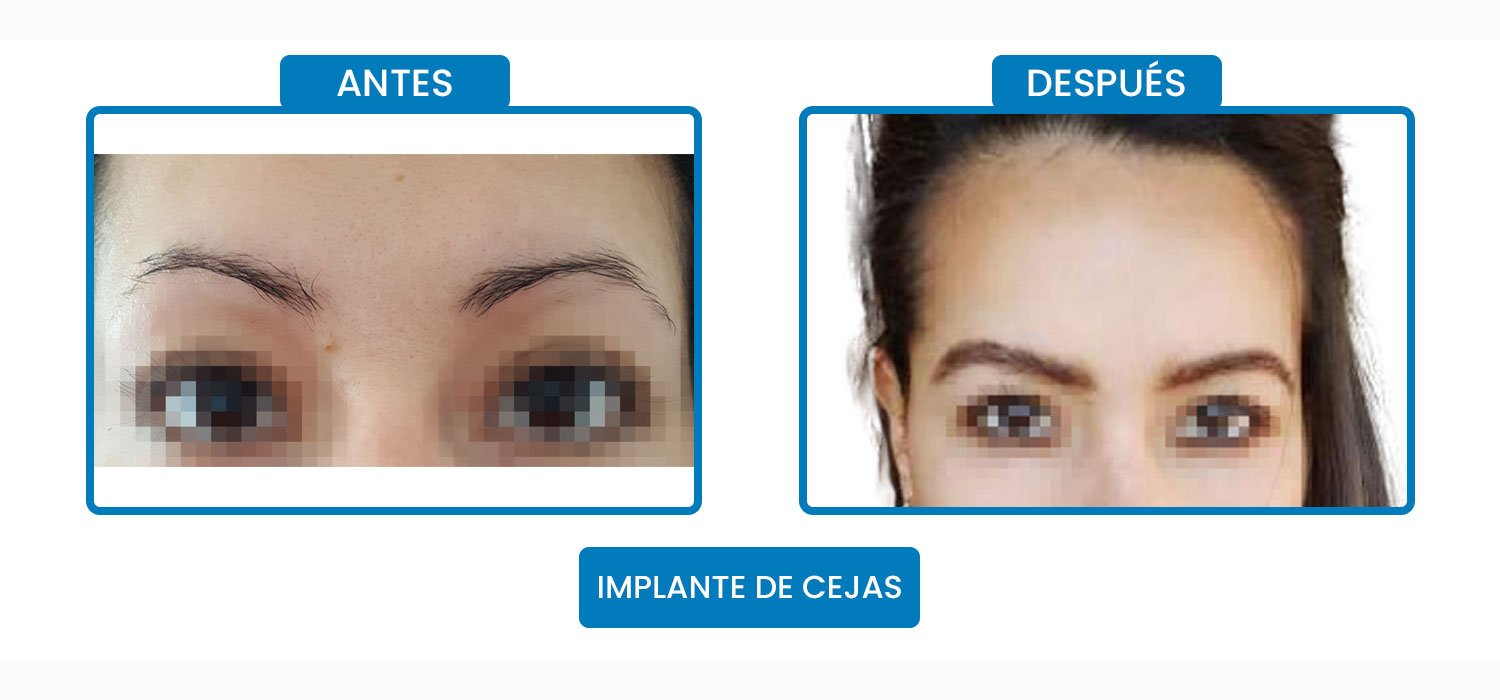 johana.jpg