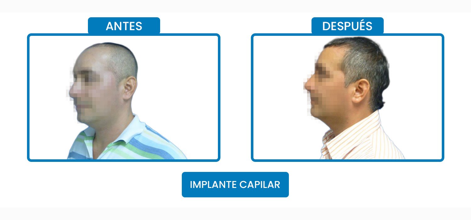 juan.jpg