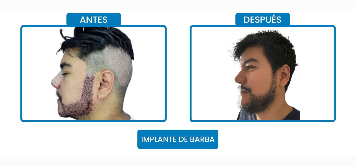 miguel.jpg